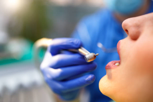 Best Wisdom Tooth Removal  in Yucos, CA